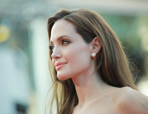 11 Celebs That Have Had Tattoos Removed